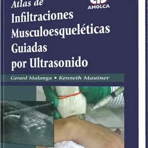 Atlas de Infiltraciones Musculoesqueléticas Guiadas por Ultrasonido