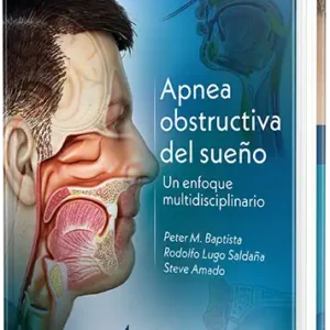 Apnea obstructiva del sueño. Un enfoque multidisciplinario