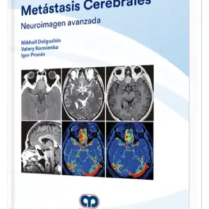 Metástasis Cerebrales. Neuroimagen Avanzada