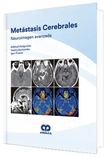 Metástasis Cerebrales. Neuroimagen Avanzada