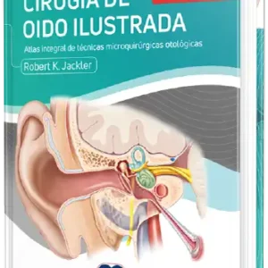 Cirugía de Oido Ilustrada