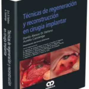 Técnicas de Regeneración y Reconstrucción en Cirugía Implantar