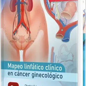 Mapeo linfático clínico en cáncer ginecológico