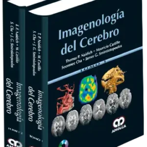Imagenología del Cerebro
