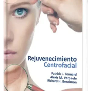 Rejuvenecimiento Centrofacial