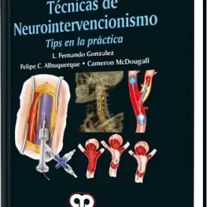 Técnicas de Neurointervencionismo