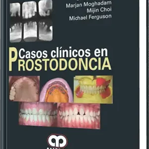 Casos Clínicos en Prostodoncia