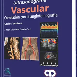Ultrasonografía Vascular