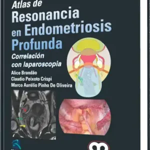 Atlas de Resonancia en Endometriosis Profunda