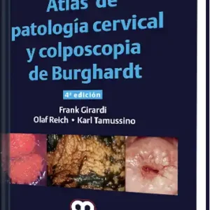 Atlas de Patología Cervical y Colposcopia de Burghardt. 4 Edición