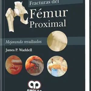 Fracturas del Fémur Proximal
