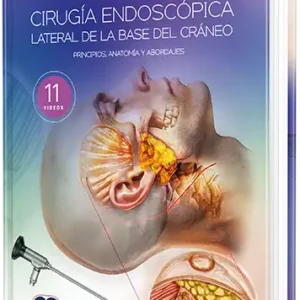 Cirugía endoscópica lateral de la base del cráneo. Principios, anatomía y abordajes