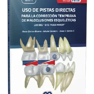 Uso de Pistas Directas para la corrección temprana de maloclusiones esqueléticas