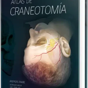 Atlas de Craneotomía