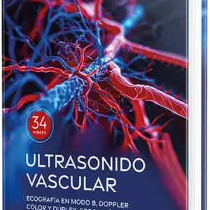 Ultrasonido vascular. Ecografía en Modo B, Doppler color y dúplex, ecografía con contraste mejorado