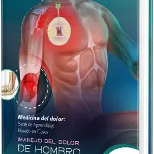 Manejo del dolor de hombro y codo