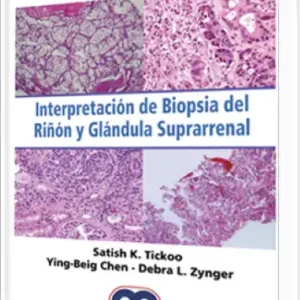 Interpretación de Biopsia del Riñón y Glándula Suprarrenal