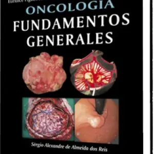 Oncología. Fundamentos Generales