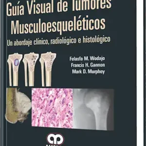 Guía Visual de Tumores Musculoesqueléticos
