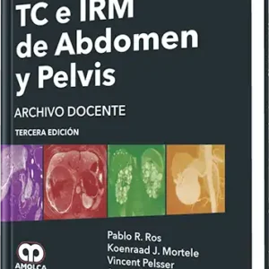 TC e IRM de Abdomen y Pelvis 3 Edición