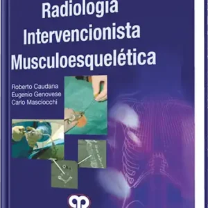 Radiología Intervencionista Musculoesquelética