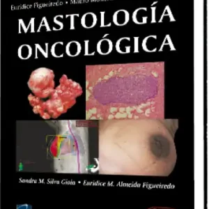 Mastología Oncológica
