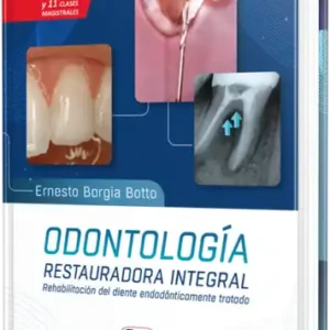 Odontología restauradora integral. Rehabilitación del diente endodónticamente tratado