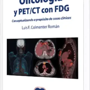 Oncología y PET / CT con FDG