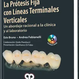 La Prótesis Fija con Líneas Terminales Verticales