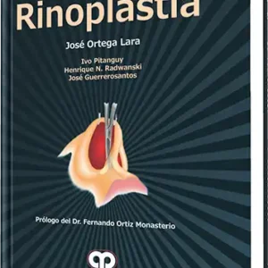 Rinoplastia