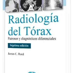 Radiología del Tórax. Patrones y Diagnósticos Diferenciales. 7 Edición