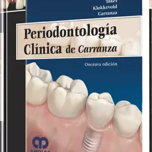 Periodontología Clínica de Carranza. 11 Edición