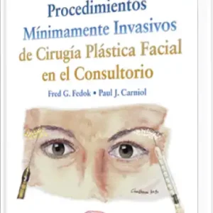 Procedimientos Mínimamente Invasivos de Cirugía Plástica Facial en el Consultorio
