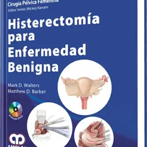 Histerectomía para Enfermedad Benigna