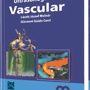 Ultrasonografía Vascular