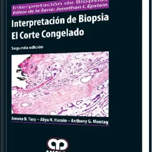 Interpretación de Biopsia el Corte Congelado 2 Edición