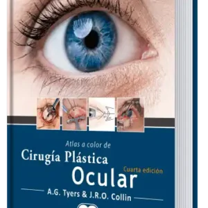 Atlas a Color de Cirugía Plástica Ocular. 4 Edición
