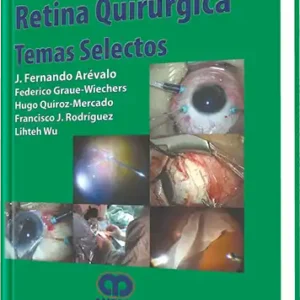 Retina Quirúrgica