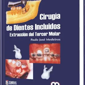 Cirugía de Dientes Incluidos Extracción del Tercer Molar