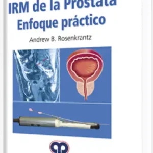 IRM de la Próstata Enfoque Práctico