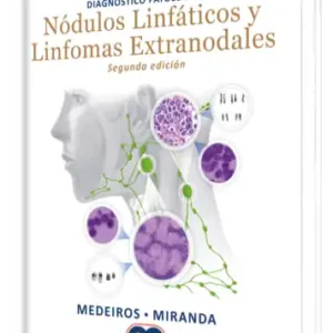 Diagnóstico Patológico Nódulos Linfáticos y Linfomas Extranodales. 2 Edición