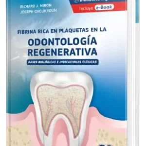 Fibrina Rica en Plaquetas en la Odontología Regenerativa