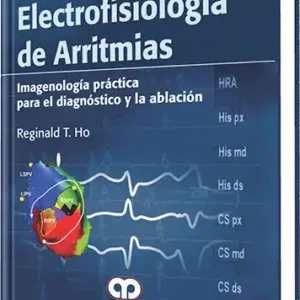 Electrofisiología de Arritmias