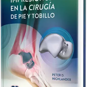 Impresión 3D en la cirugía de pie y tobillo