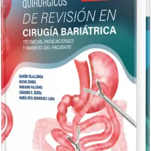 Procedimientos Quirúrgicos de Revisión en Cirugía Bariátrica. Técnicas, Indicaciones y Manejo del Paciente