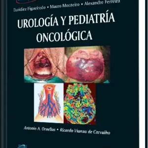 Urología y Pediatría Oncológica