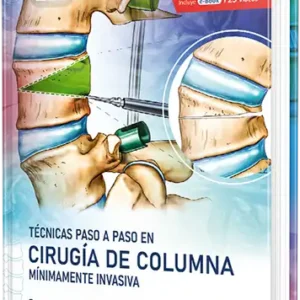 Técnicas paso a paso en Cirugía de Columna mínimamente invasiva