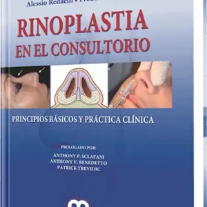 Rinoplastia en el Consultorio