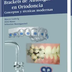 Brackets de Autoligado en Ortodoncia