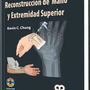 Reconstrucción de Mano y Extremidad Superior
